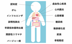 歯周病が全身疾患に繋がってしまう仕組みを解説｜全身疾患名の画像｜恵比寿の歯医者 恵比寿デンタルクリニック東京