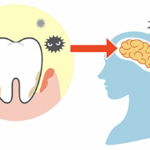 歯周病が全身疾患に繋がってしまう仕組みを解説