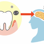 歯周病が全身疾患に繋がってしまう仕組みを解説｜アイキャッチ画像｜恵比寿の歯医者 恵比寿デンタルクリニック東京