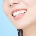 恵比寿デンタルクリニック東京｜エアフローPMTCとは？｜白い歯を見せて笑う女性の画像